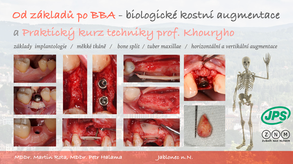 Od základů k BBA - 28-29.3.2025