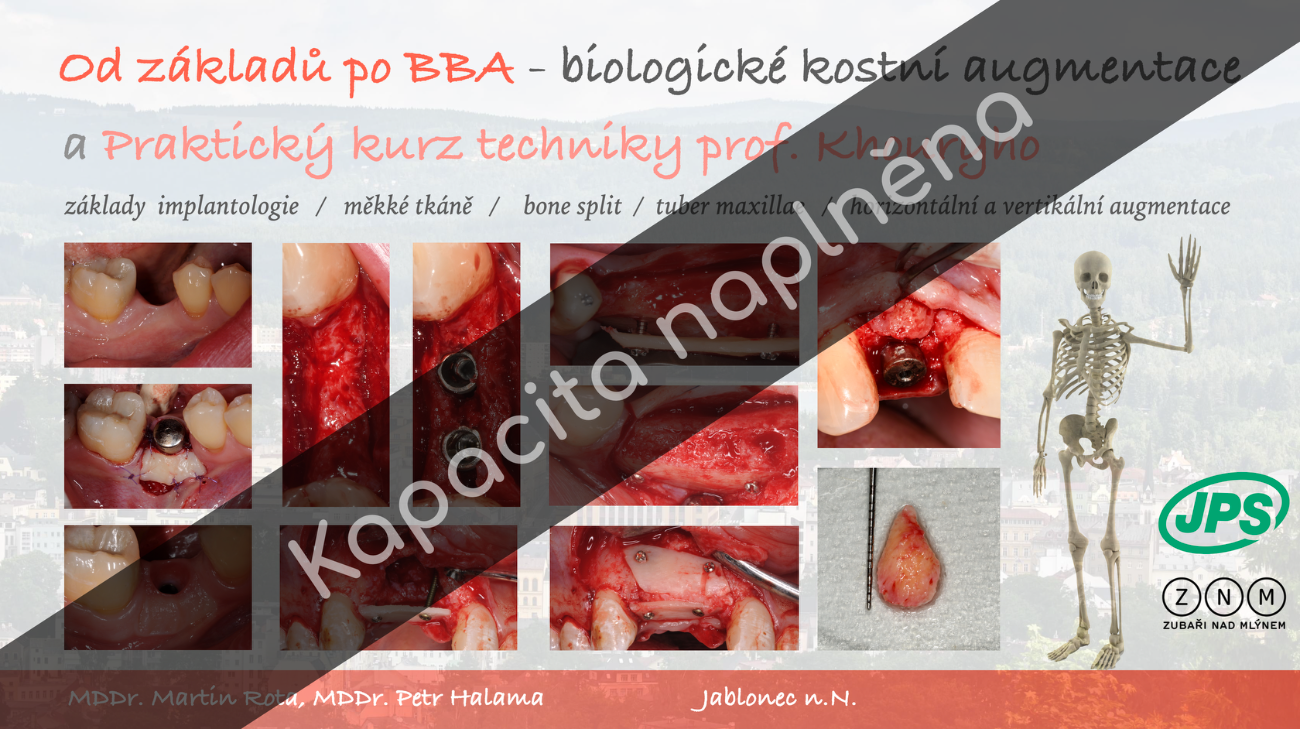 Od základů k BBA - 14-15.2.2025