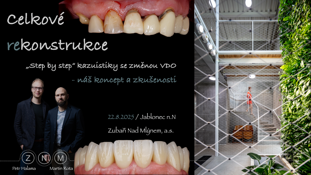 Celkové rekonstrukce