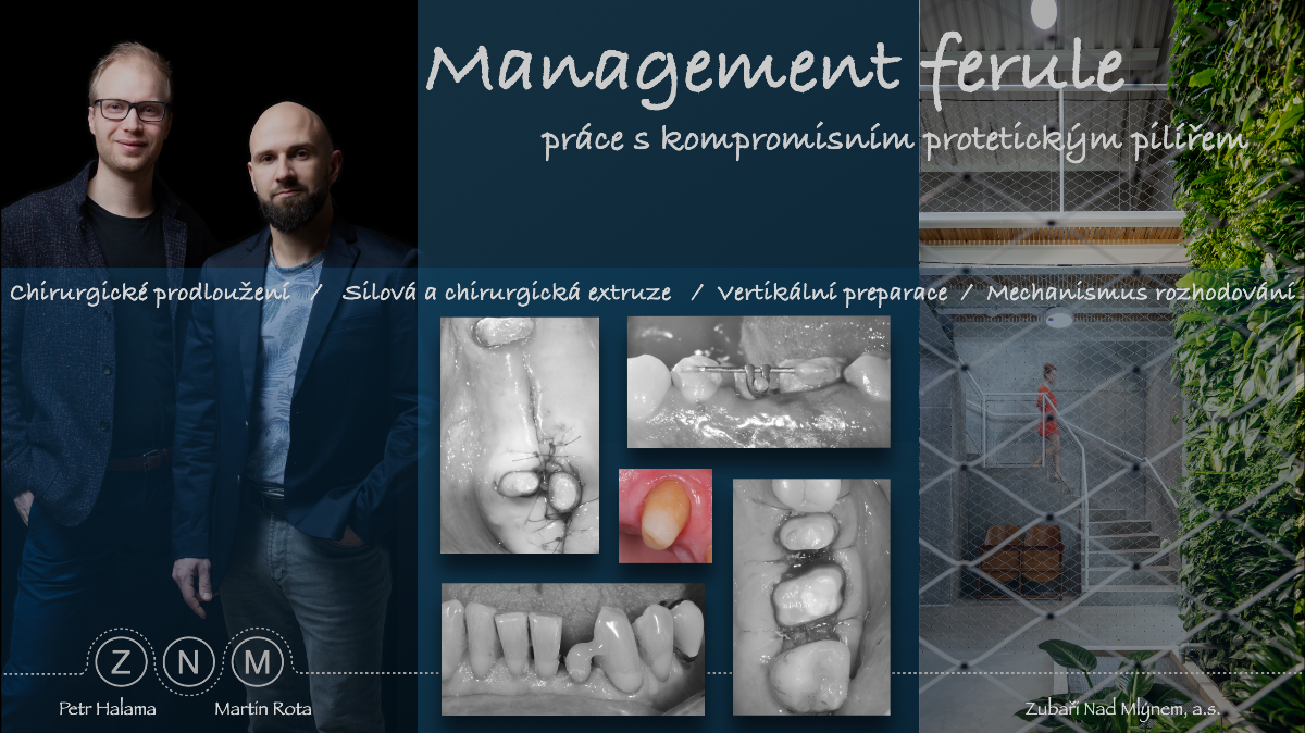 Management kompromisního pilíře  - updated 2025